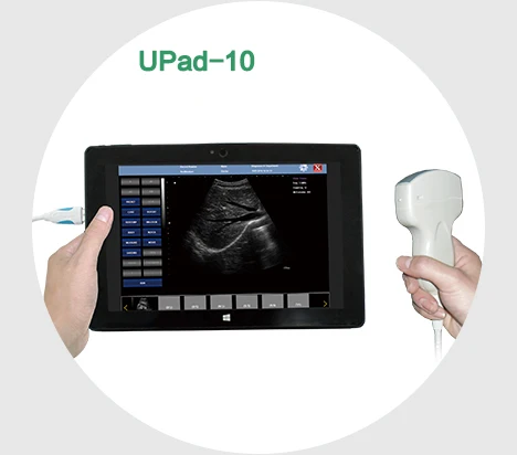 UProbe-20 Probe Type Ultrasound Scanner work with computer(windows) or tablet/phone(Androi), connect by USB Cable