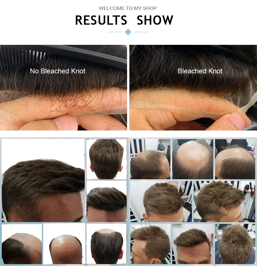 Q6 Men's Toupee Lace & PU Base Human Hair System Unit Durable Male Hair Prosthesis Wig for Full Coverage Hair Loss