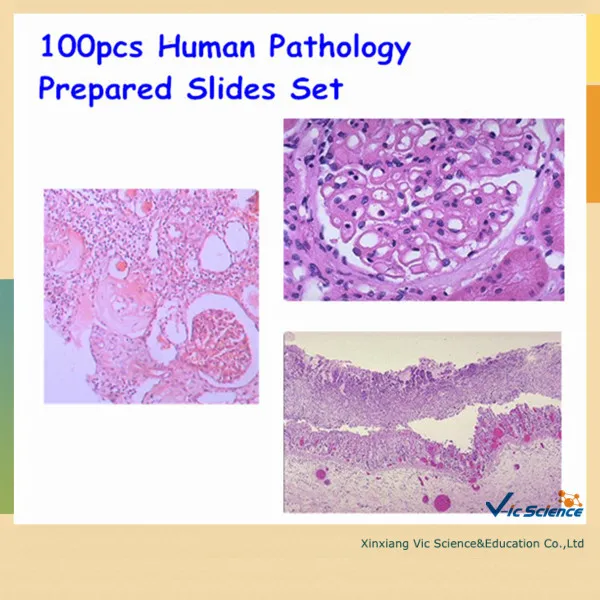 100pcs Human Pathology Prepared Slides Set