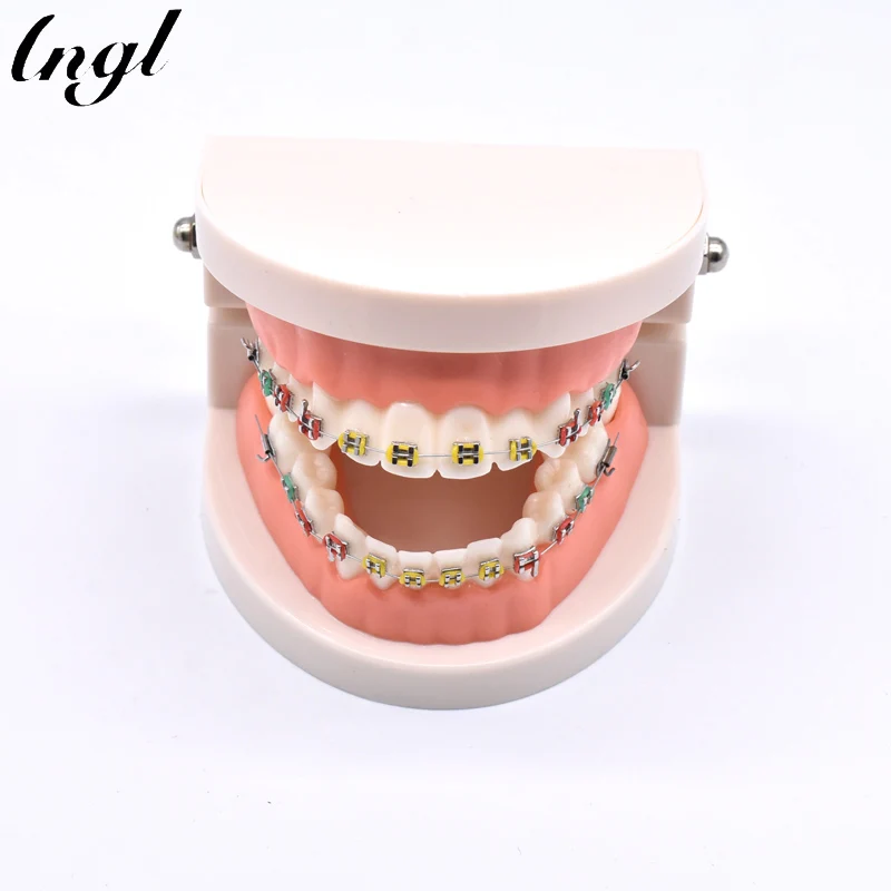 Dental Orthodontic Treatment Model With Ortho Metal Ceramic Bracket Arch Wire Buccal Tube Ligature Ties Dental Tools Dentist Lab