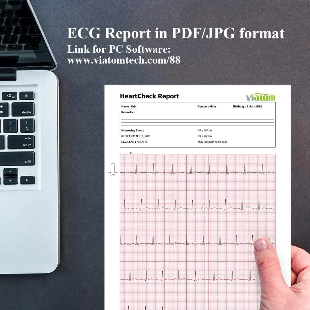 Home Handheld ECG Holter Monitor with Oxygen Saturation SPO2 PR Cuffless Blood Pressure HD Touch Screen Heart Health EKG Tracker