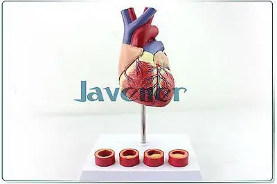 

1:1 Life Size Human Anatomical Anatomy Heart Medical Model +Thrombosis Model