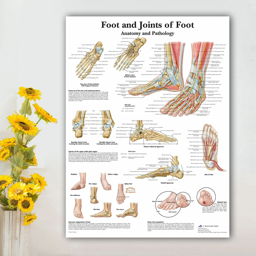 Foot Joints of Foot Chart Anatomy Pathology Poster Canvas Painting Wall Pictures for Medical Education Doctors Office Classroom