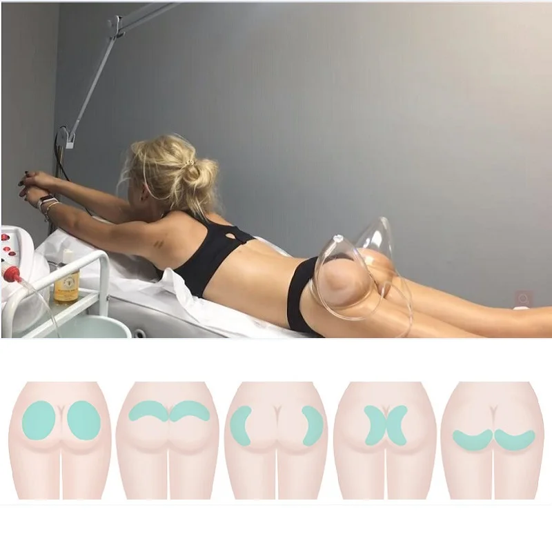 Hot sale buttocks lifter cup vacuum breast enlargement therapy cupping machine bigger butt hip enhancer machine