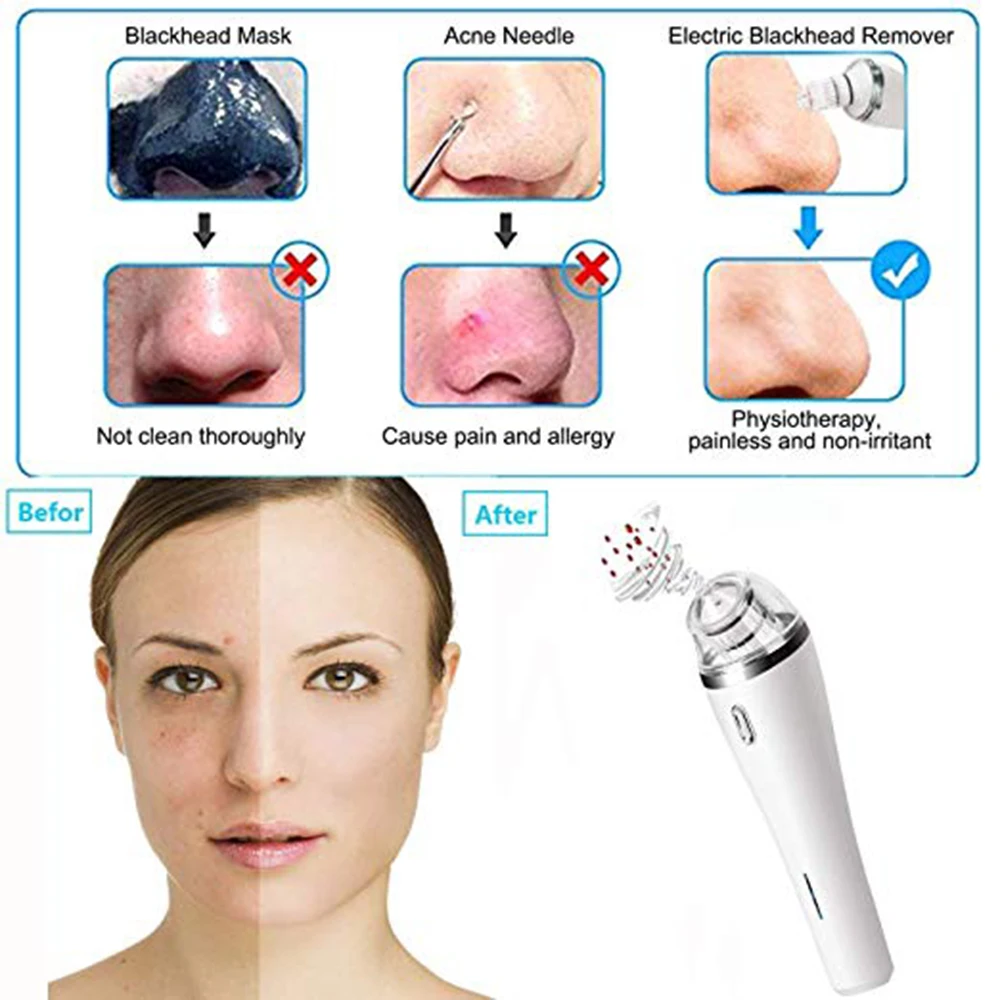 Skin Care Pore Vacuum Blackhead Remover Acne Pimple Removal Vacuum Suction Tool Face Clean Facial Diamond Dermabrasion Machine