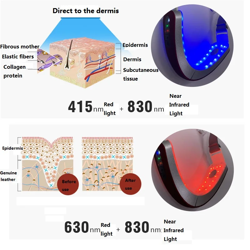 Mặt Mỏng Hiện Vật Vi Hiện Tại Máy Mát Xa Da Mặt Mặt-Nâng Nhạc Cụ V Mặt Mỏng Masseter Đỏ Blu-ray Làm Đẹp Nhạc Cụ