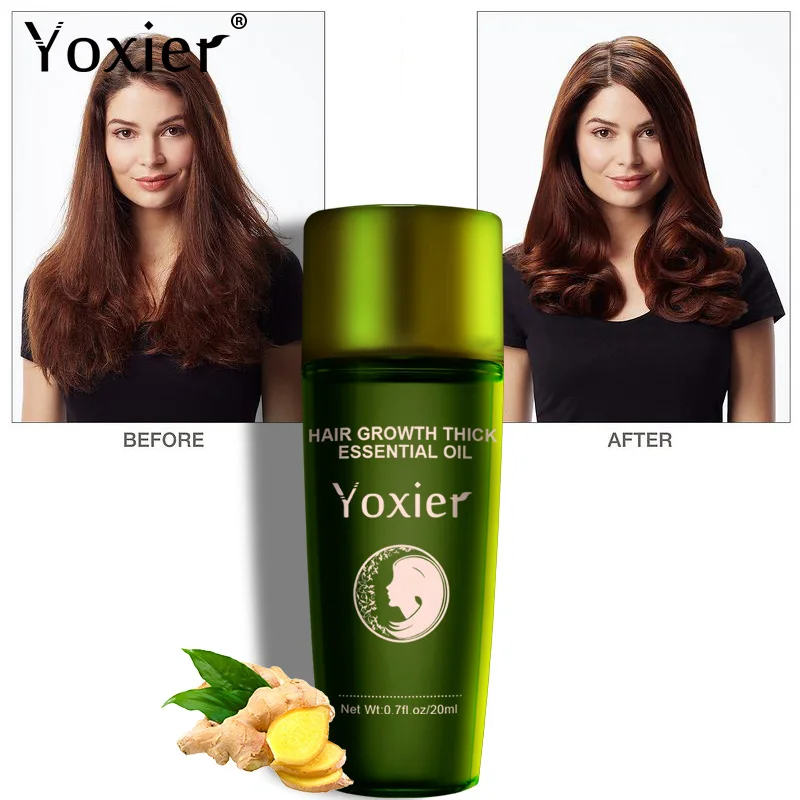 Yoxier Hair Growth Essence Oil Hair Loss Products Health Care Repair Damaged Hair Anti Dandruff Relieve Itching 10PCS/LOT