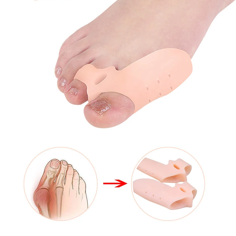 Corrector de juanete de silicona, separador de dedos de los pies, alisador de dedos de los pies, almohadilla de callos Hallux Valgus, 2 uds.