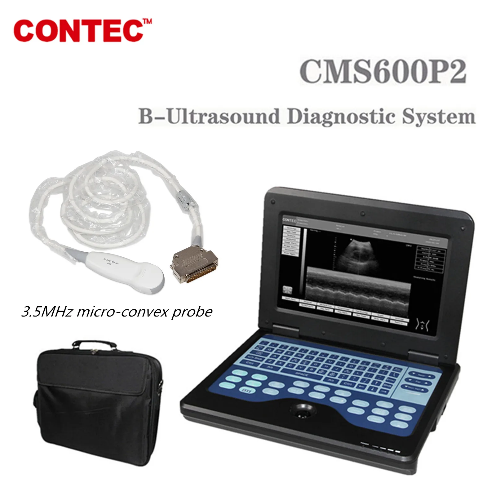 CONTEC CMS600P2 with cardiac probe Portable B-untrasound  Laptop Machine Digital Ultrasound Scanner 3.5Mhz Convex Probe