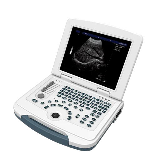 Cheapest price Laptop Digital 15 inch 2D 3D 4D obstetric gynecology ultrasound medical scanner medical ultrasound instruments