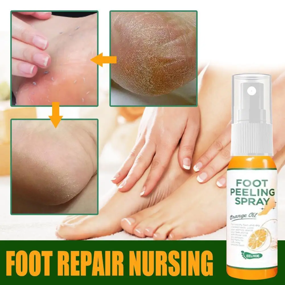 30 / 100ML Foot Exfoliating Spray Foot Peeling Dead Skin Remove Spray Natural Orange Essence Pedicure Hand Callus Whitening Care