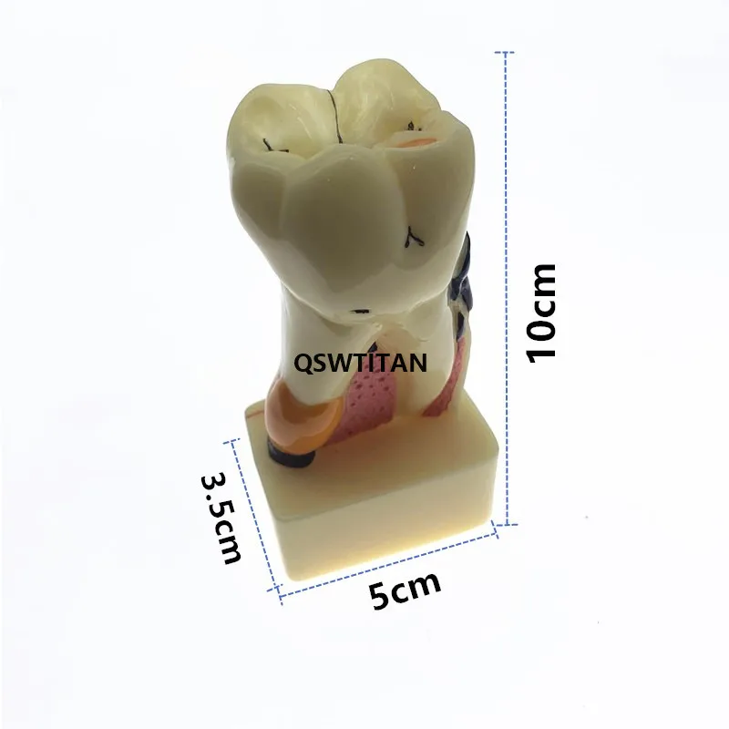 Dental Teeth Model 4 times tooth pathology model Comprehensive Periodontal Model For Teaching Study model