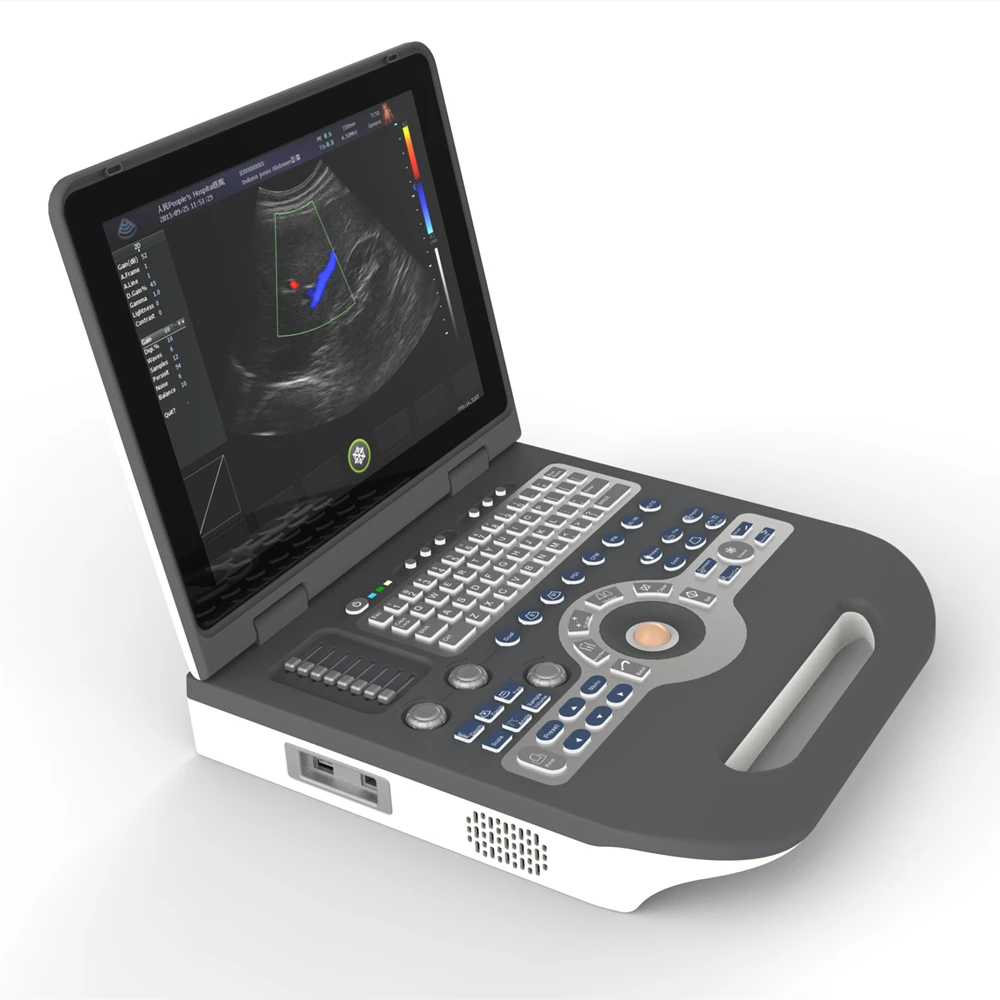 15inch Led 2D 3D 4D 128 Elements Notebook Ultrasound Scanner Color Doppler Machine