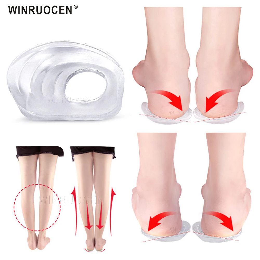 Silicon Gel Unisex O/X Leg Valgus Varus Corrector Orthotic Insoles Foot Pads Heel Correction Pads Flatfoot Support Insert