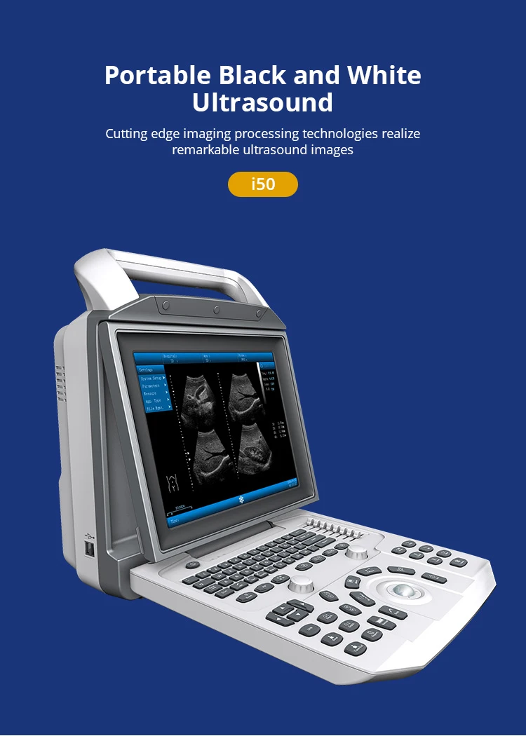 ماكينات بالموجات فوق الصوتية المحمولة PBWU50 التصوير PW أشعة موجات فوق صوتية دوبلر الماسح الضوئي أدوات الموجات فوق الصوتية الطبية