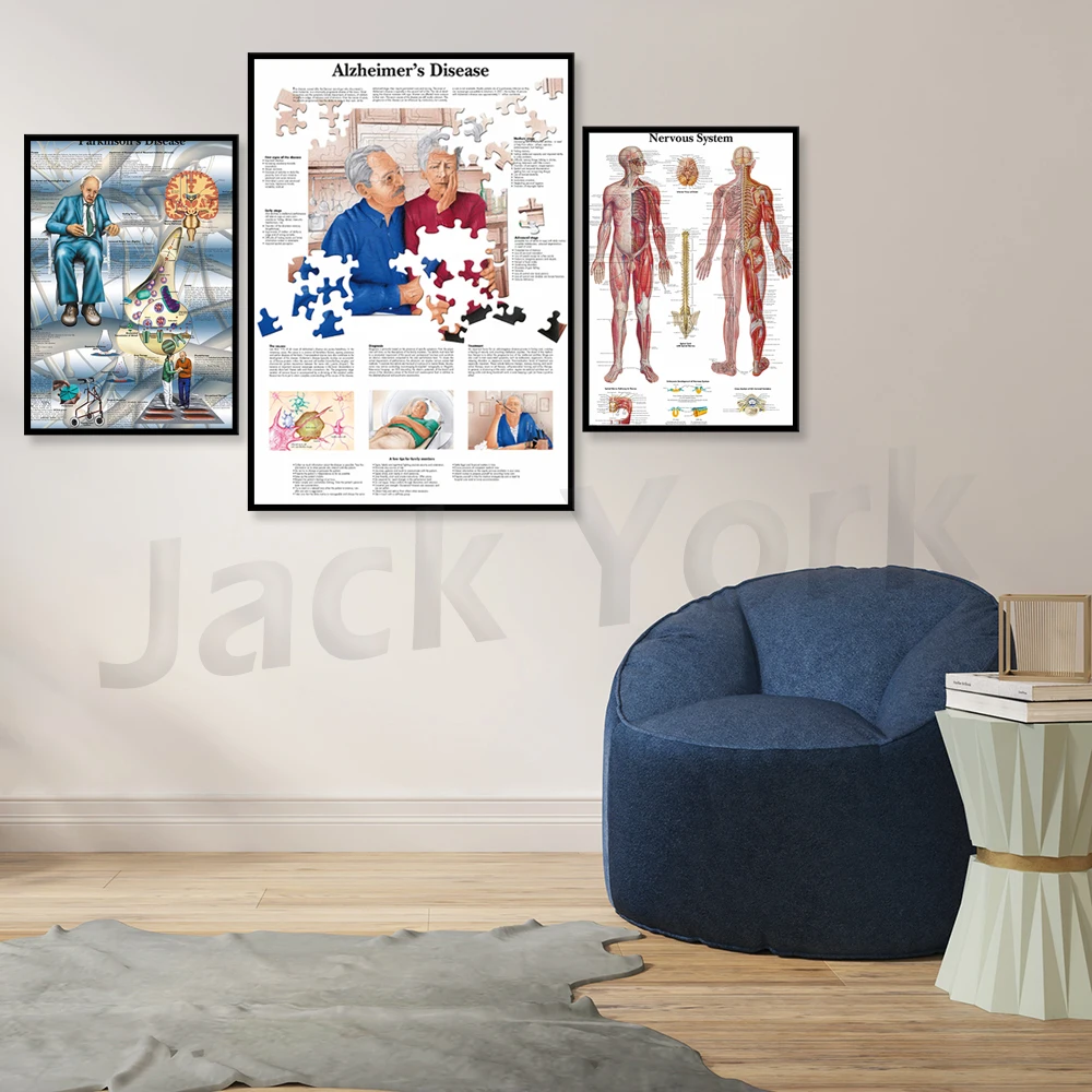 Human Nervous System Chart Poster Map Canvas Painting Wall Pictures for Medical Education Doctors Office Classroom Home Decor