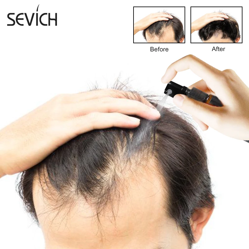 Sevich Natural Organic Plant Hair Growth Essence Oil Hair Loss Treatment Hair Oil for Fast Hair Growth Spray 1pcs Men and Women