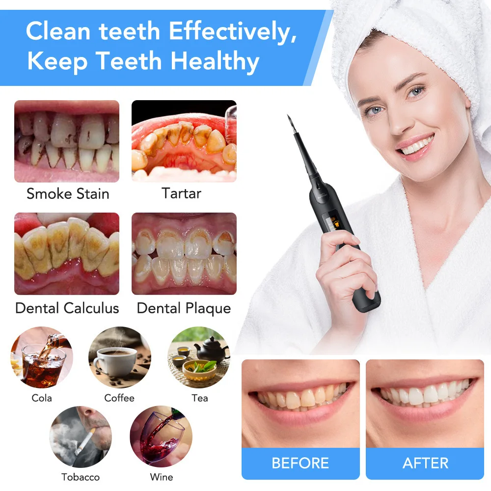 Portable dental scaler for household cleaning of dental calculus, washing teeth, removing tartar, dental health and hygiene