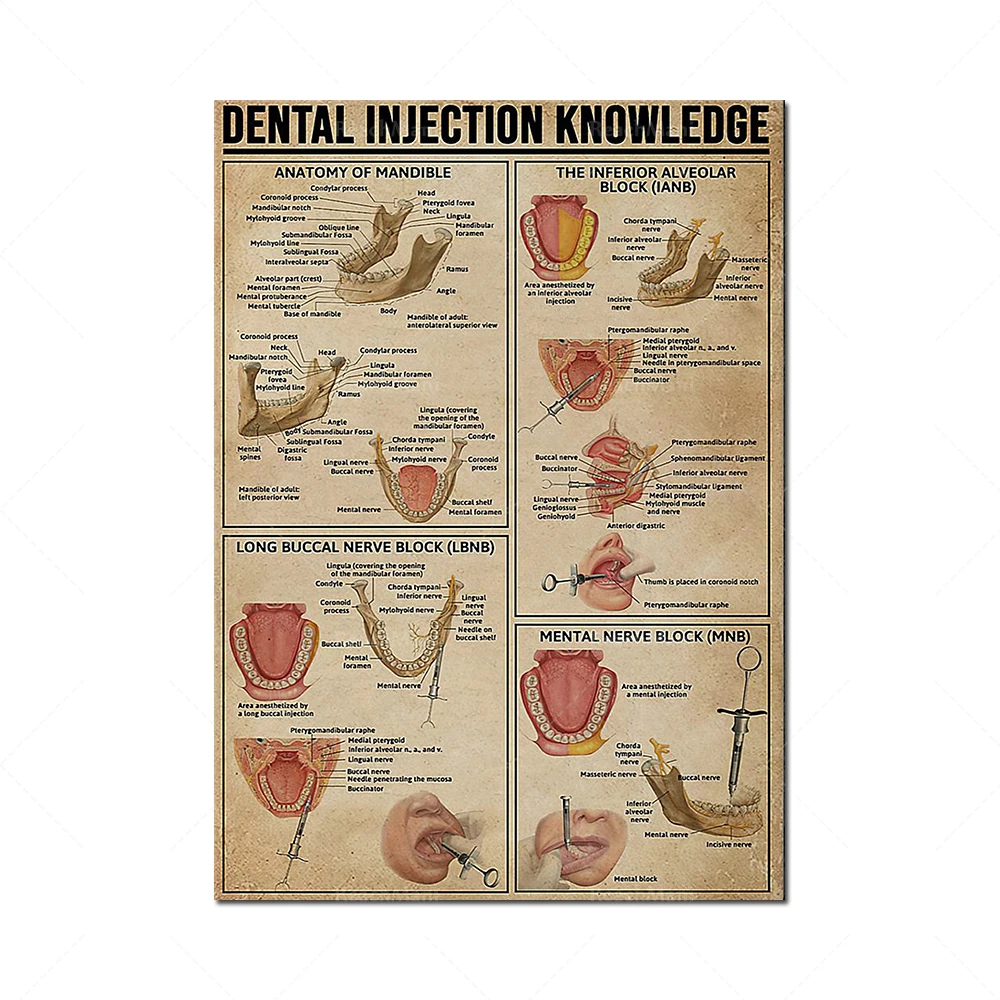 Dentist poster, dental injection knowledge, teeth and gum protection wall artist home decoration poster, dentist gift, unique gi