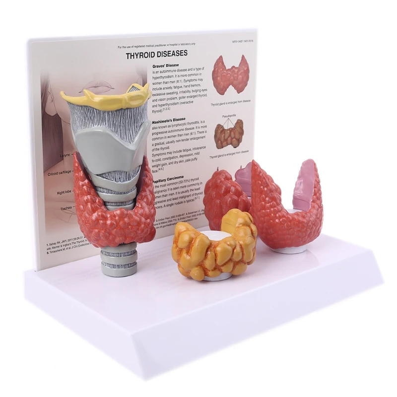 Human Anatomical Thyroid Gland Model Pathology Anatomy Digestive System Display Study Teaching Tool Halloween