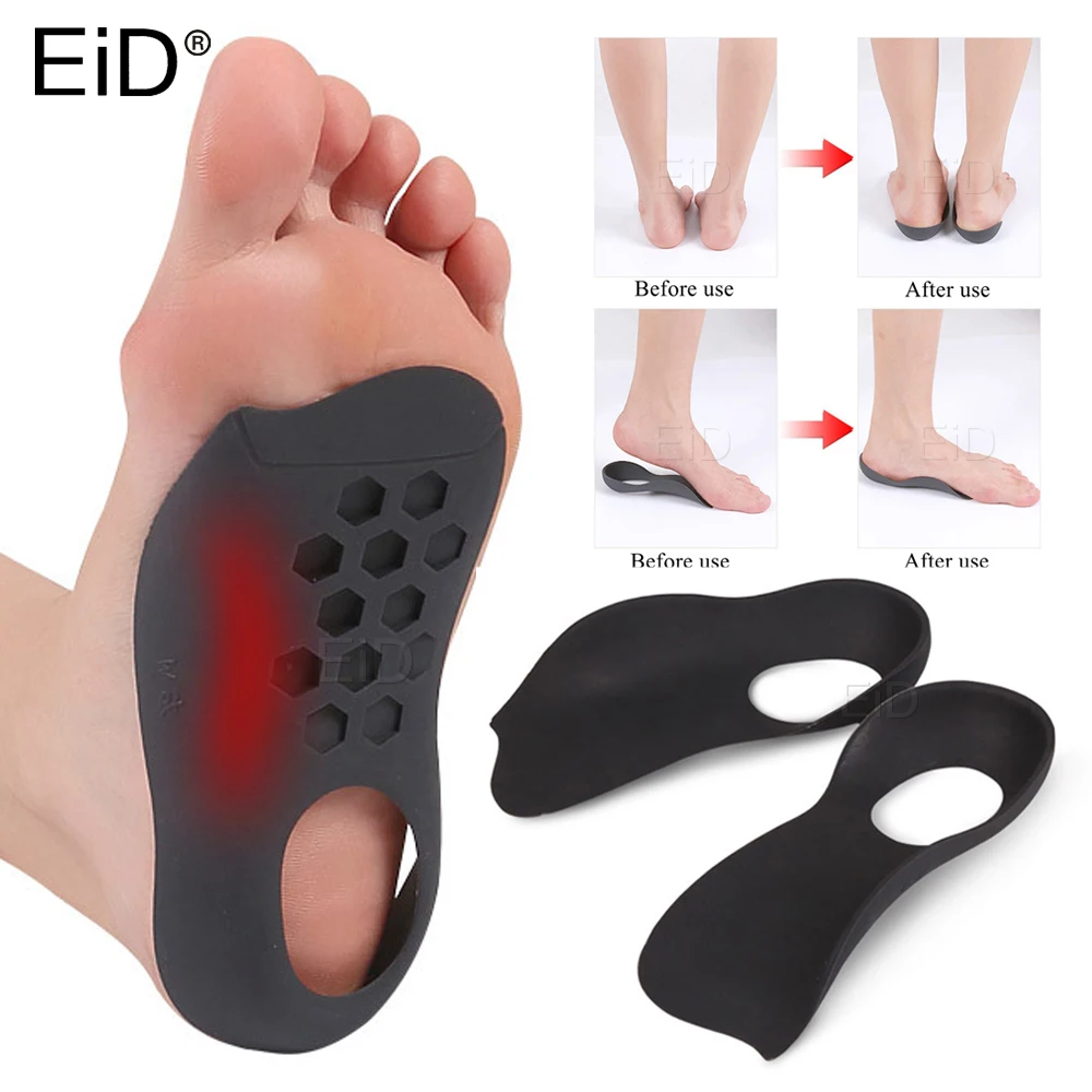 XO-Legs Orthopedic Insoles Orthotics Flat Foot Health Sole Pad For Shoes Insert Arch Support Pad For Plantar fasciitis Feet Care