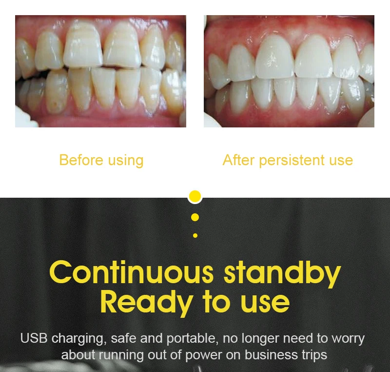 ไฟฟ้า Ultra Sonic Sonic Scaler LED Light ฟันแคลคูลัส Remover ทำความสะอาดฟันคราบ Tartar เครื่องมือ Whiten ฟัน Tartar
