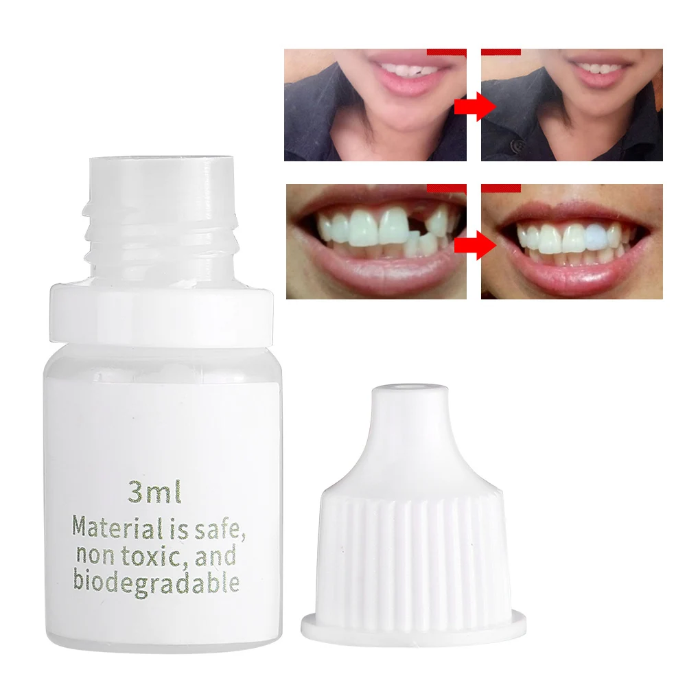 2Pcs Oral Care Dental Temporary Tooth Repair Fix Broken Teeth Restoration Fill Missing Teeth Gaps Between Teeth Filling Material