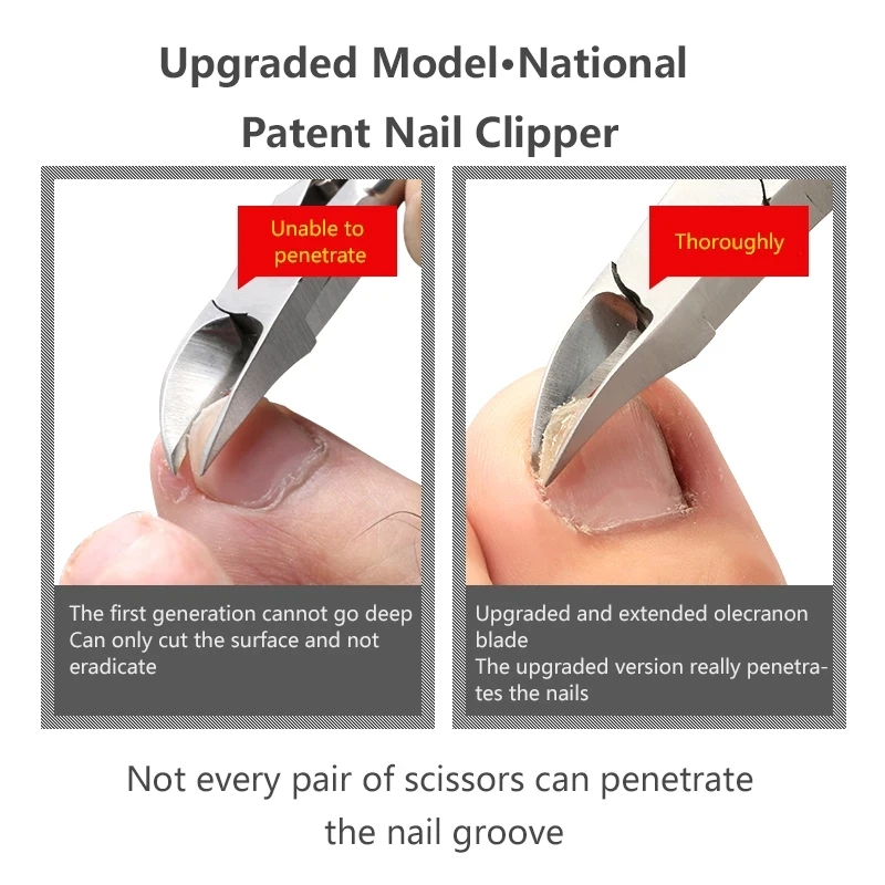 Toenail Toe Ingrown Nail Art, Cutícula Nipper, removedor de pele morta, Clipper Edge Cutter, aparador de manicure, tesoura, pedicure ferramenta