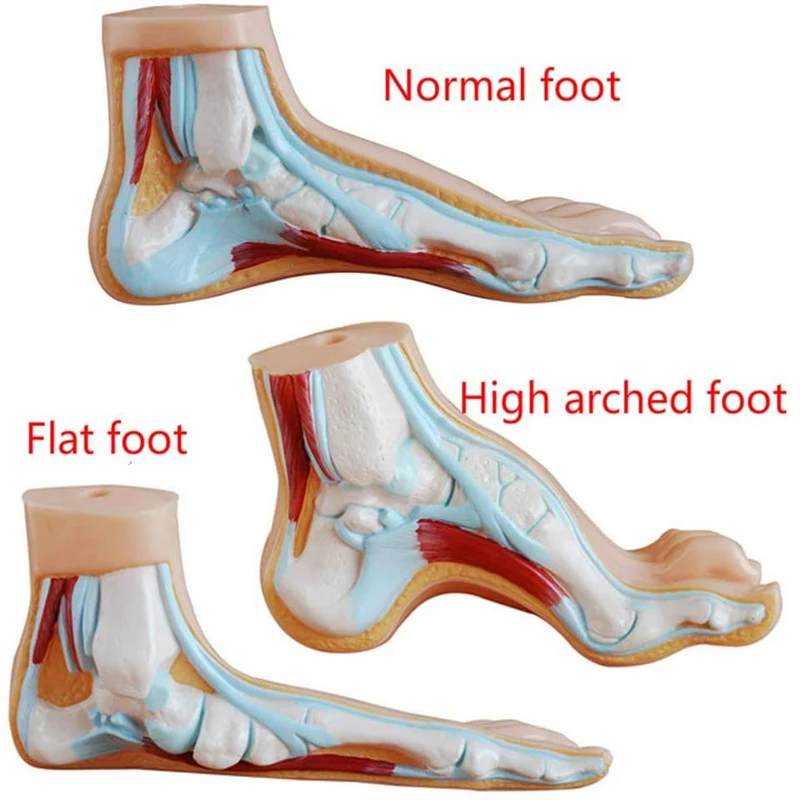 

Medical Anatomy Human Foot Normal Foot Flat and Arched Foot Anatomy Model Human Sketelon Model Flat High Arched Feet 3pcs/set