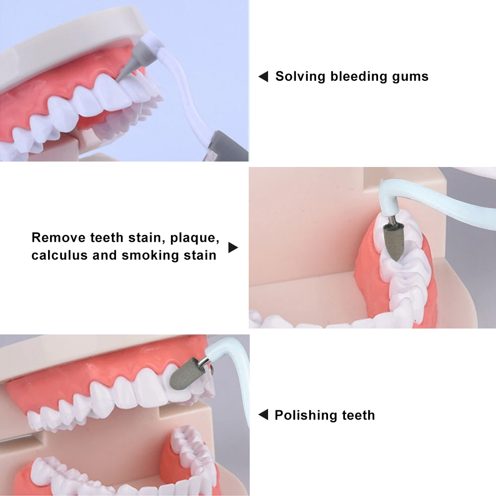 歯美白3 1でホームソニック振動hygienetoolライトオートクレーブ歯科ステイン消しゴムクリーン歯石医ツール