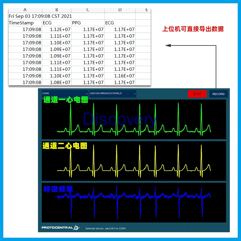 Customized ADS1293 Digital ECG Module Physiological Signal ECG Monitoring 3-channel 24-bit Analog Front End