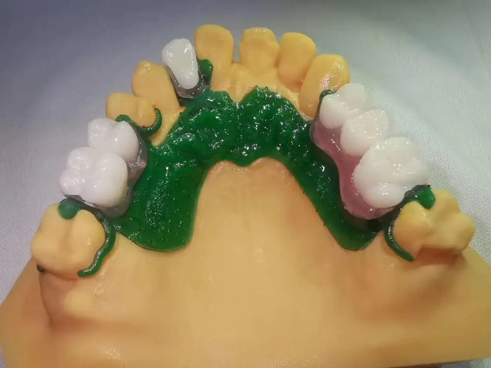 405nm Photosensitive Resin For 3D Printing Adsorption Denture (Denture Base/Temporary Tooth) For Octavelight Shining 3D  NOVA3D