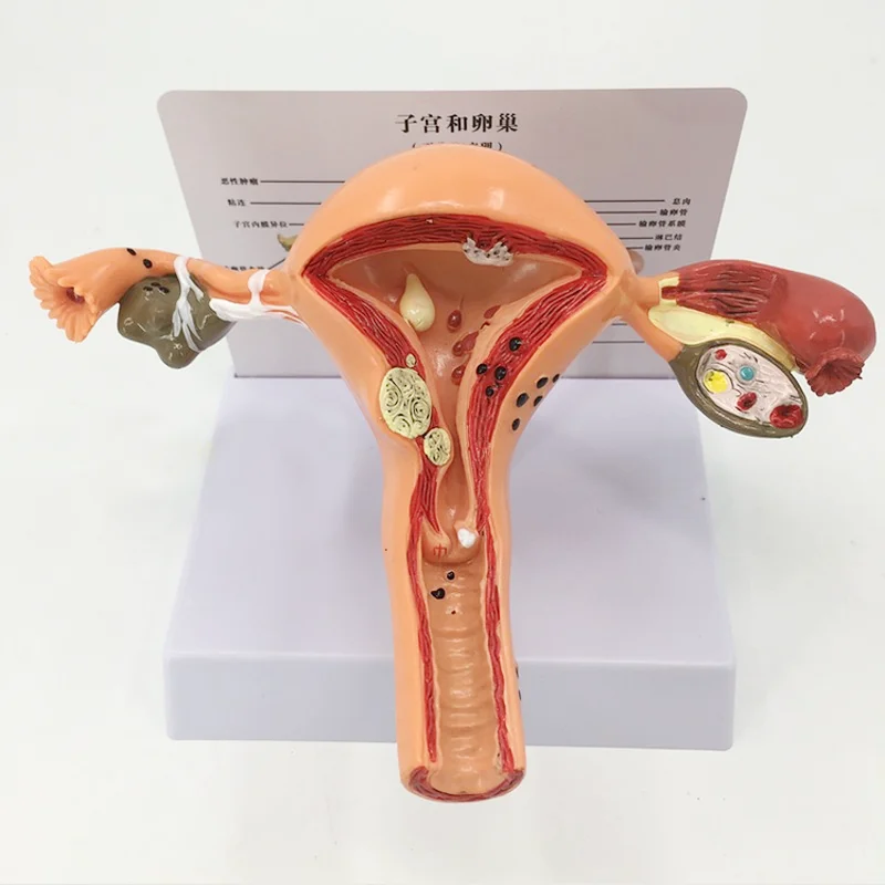 

Uterus Pathological Anatomy Teaching Model