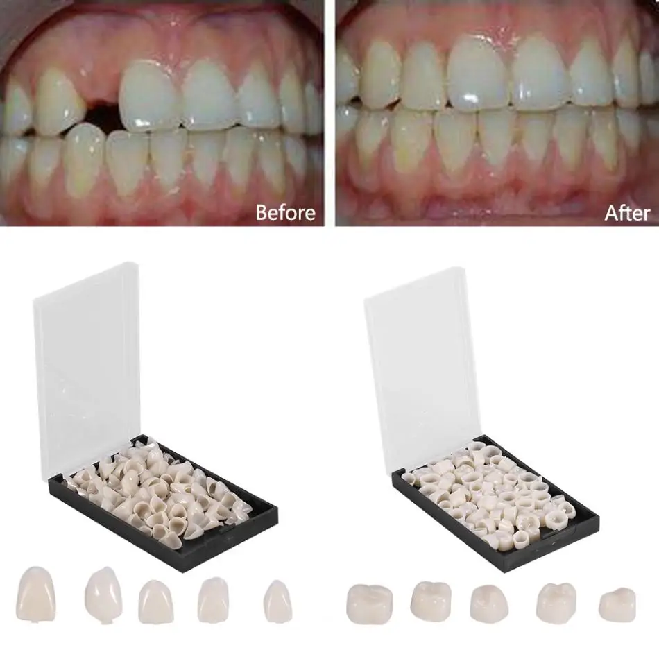 100Pc False Dental Crown Resin Porcelain Material Temporary Teeth Crown Realistic Oral Care Teeth Whitening Anterior Molar Crown