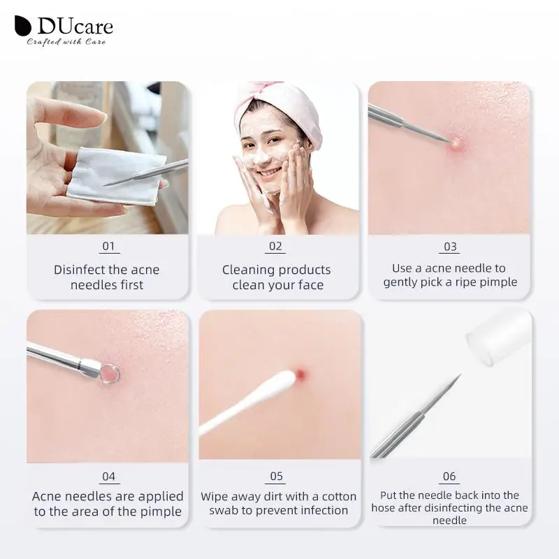 DUcare 4pcs/set Blackhead Comedone Acne Pimple Blackhead Remover Tool Spoon for Face Skin Care Tool Needles Facial Pore Cleaner