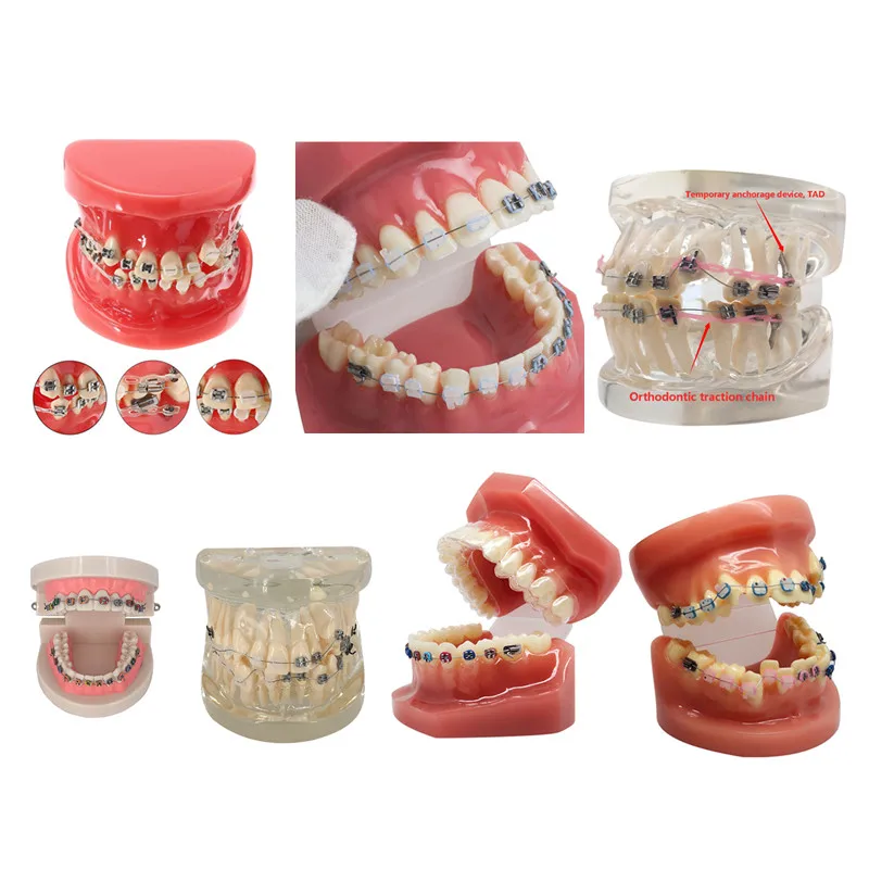 Dents de modèle de mâchoire orthodontique pour l\'étude de la dentisterie, fuchsia, dentiste, produits et accessoires, 41 styles