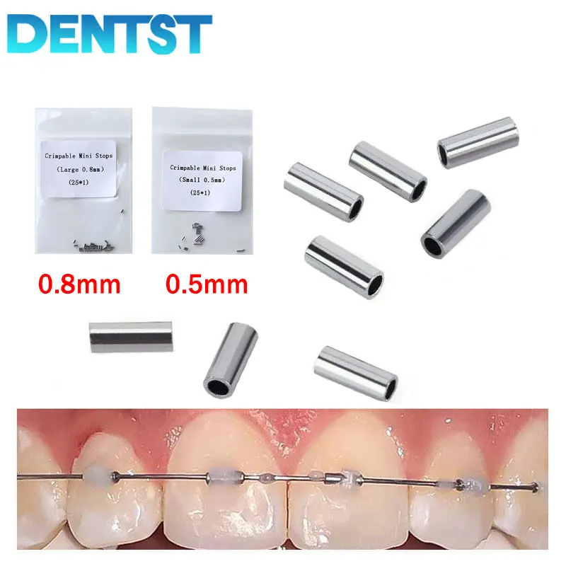 Mini butées orthodontiques à sertir sur fil d\'arc, 50 pièces, 25 pièces 0.5mm et 25 pièces 0.8mm