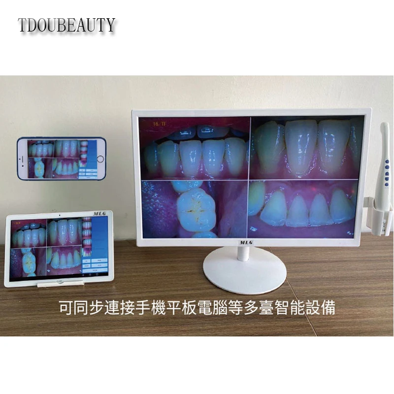 Design M-968 (2 in 1) Camera Denta LED Intraor All/Intra Oral Camera WIFI Endoscope