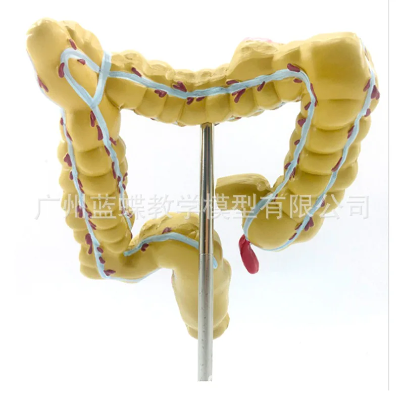1/2 Life Size Human Rectal Pathology Colon Model Large Intestine Model Anorectal Anatomical Model Tools