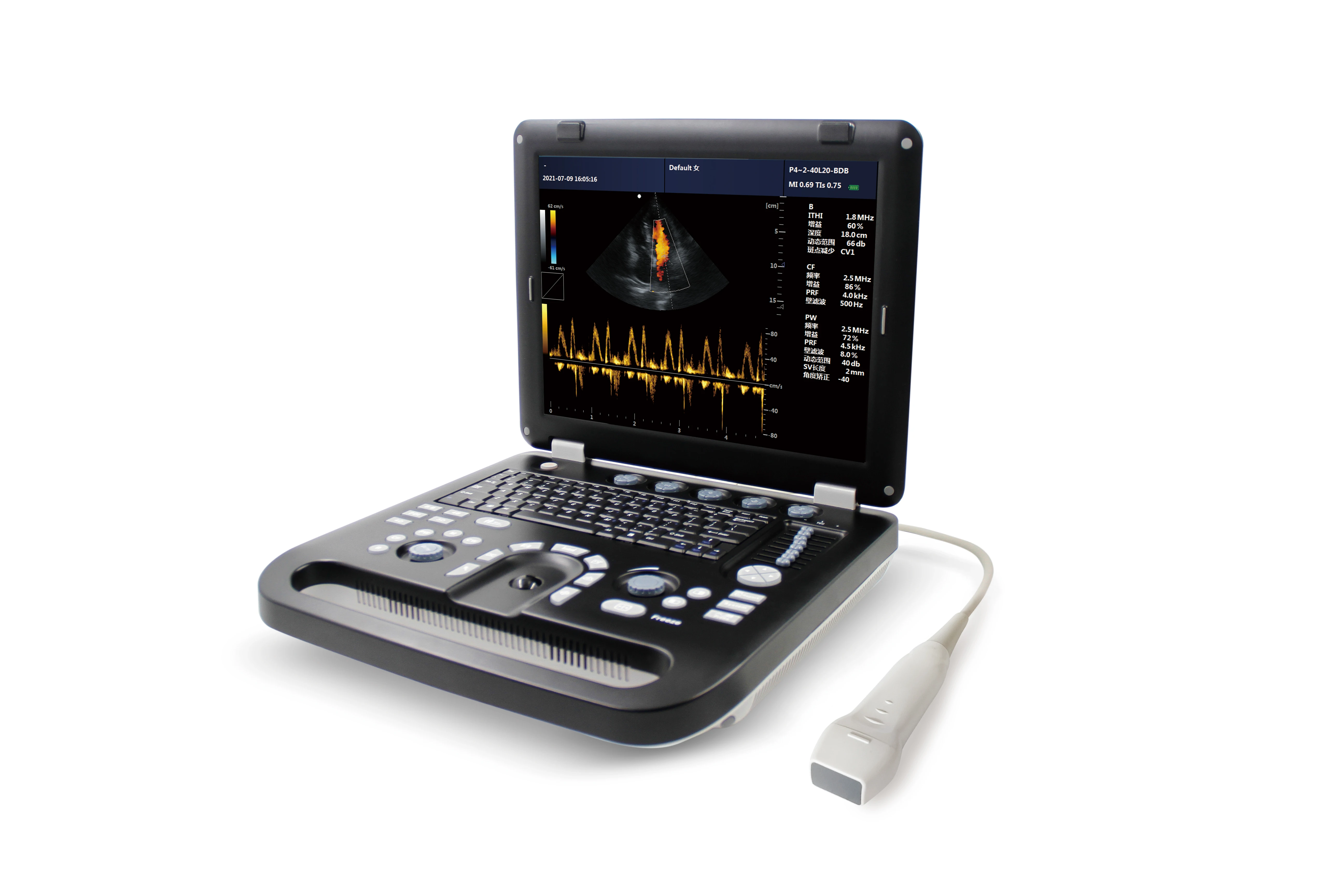 CONTEC CMS1700B Color Doppler USG Color Cardiac Ultrasound Scanner Diagnostic Machine Systems Phased Array Probe