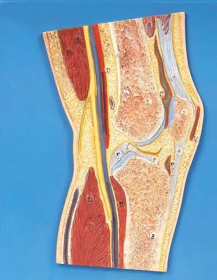 

Anatomical specimen board of human knee Human MRI Knee Joint Skeletal Muscle Section Structure Medicine Orthopedics