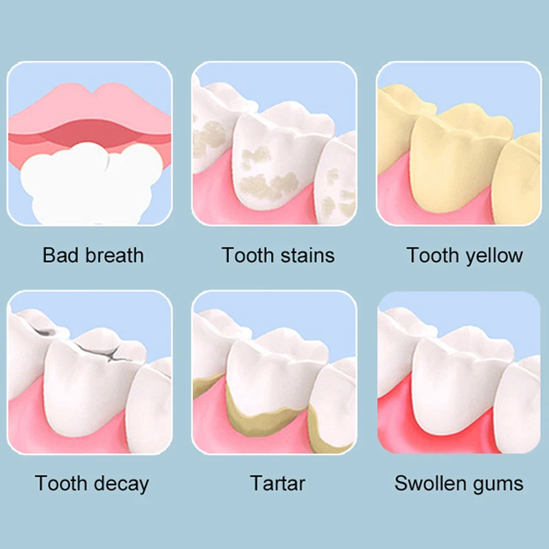 Ирригатор полости рта портативный с зарядкой от USB, 5 насадок, 3 режима
