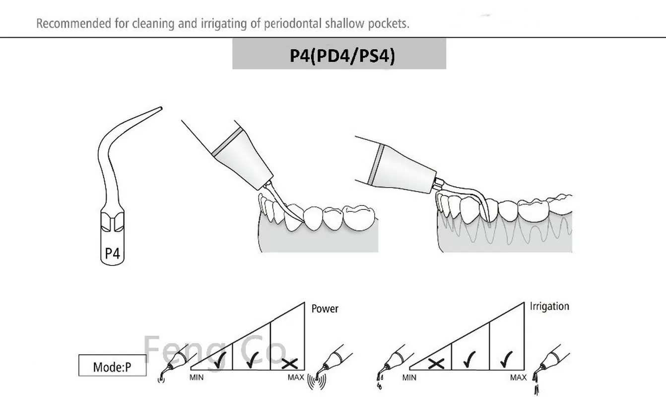 PD4 Dental Ultrasonic Scaler Tips Scaling  Endo Perio Fit SATELEC NSK DTE GNATUS HU-FREIDY Handpiece Dentist Teeth Whitening