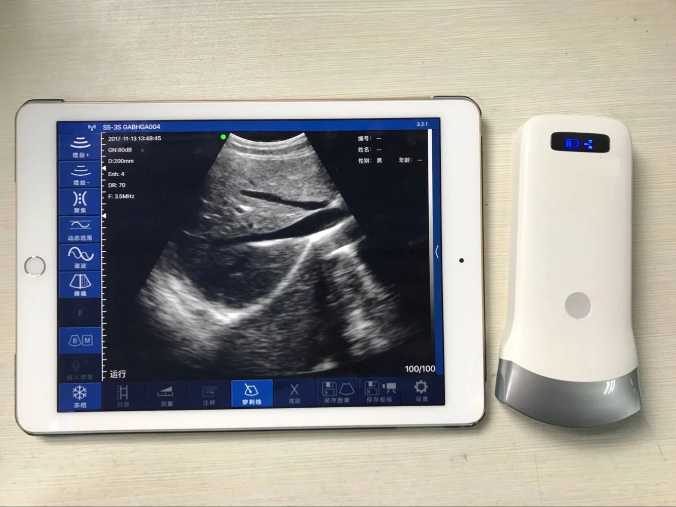 Sonda de ultrasonido portátil wifi, dispositivo inalámbrico de ultrasonido doppler a color para teléfono android, ipad