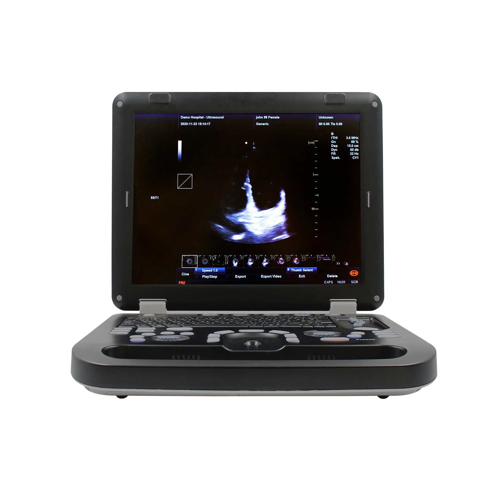 Portable Color Doppler CONTEC CMS1700A CMS1700B CMS1700C Ultrasound Scanner Machine+ convex Probe 2021 newest