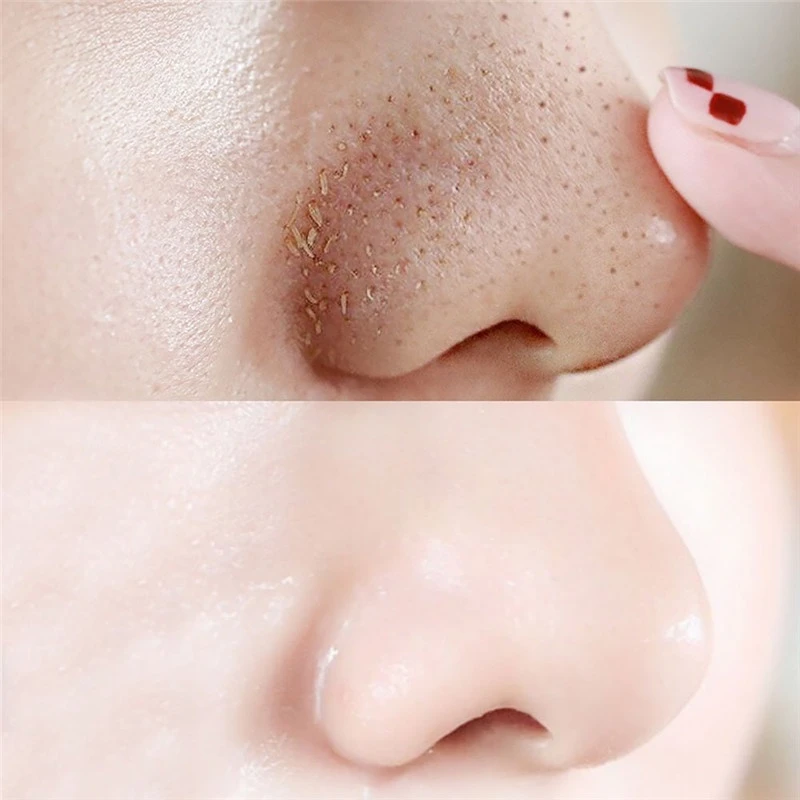 10pcs Nose Blackhead Remover Mask Skin Care Shrink Pore Acne Treatment Mask Deep Nose Pore Cleansing Strips Black Head Remover image 3