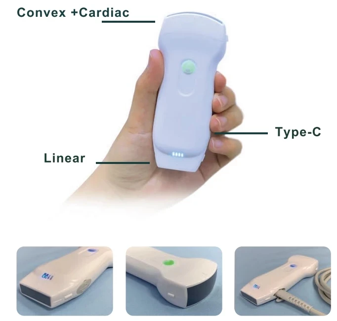 128E Color Doppler 3 In 1 Convex+Linear+ Cardiac Wireless Double Head Ultrasound Scanner Probe