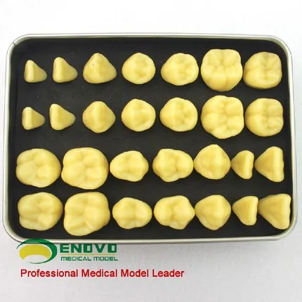 

Dental caries dental caries dental model