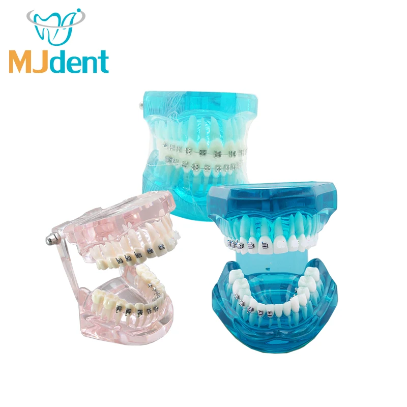 Dentist Patient Communication Model Dental Orthodontic Teeth Model with Lingual Metal Ceramic Brackets