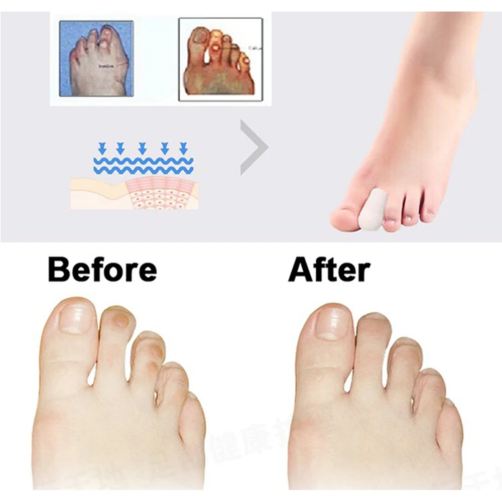 6Pcs=3Pairs Soft Silicone Tube Toe Protector Foot Corn Blisters Calluses Protection Pad Bunion Finger Pain Relief Massager Tool